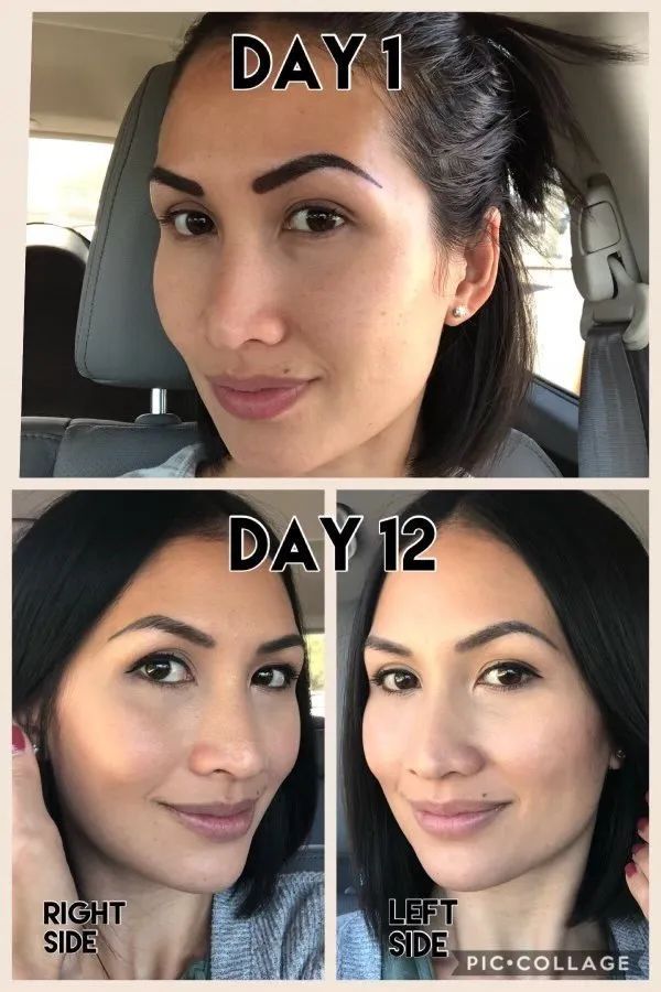 before and after permanent makeup