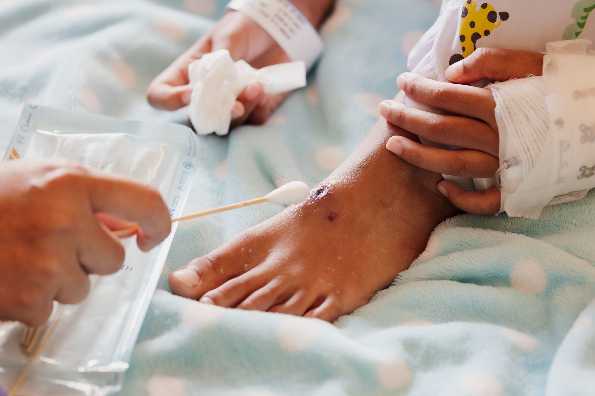 Cleaning wound on child's foot Cleaning wound on child's foot