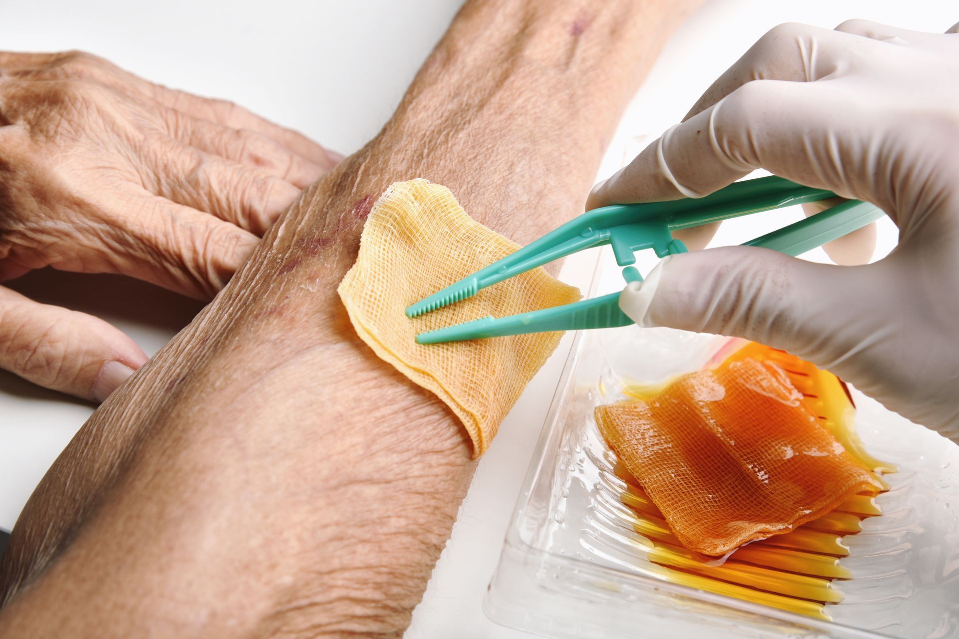 Caregiver dressing elderly patient's wound
