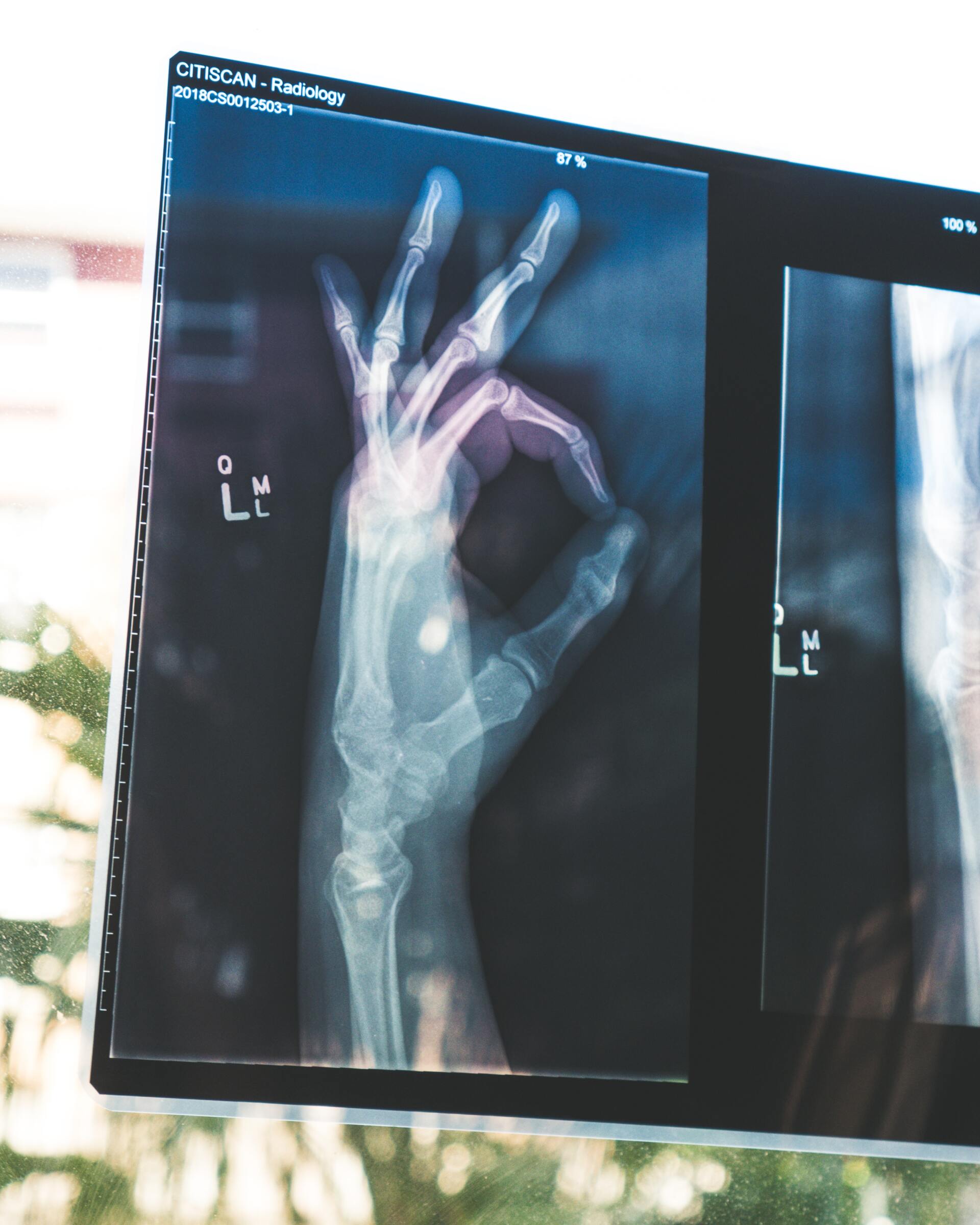 image of medical X-ray
