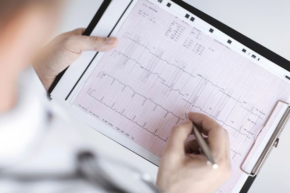 Persona revisando un ECG en una tableta con un lápiz óptico sujeto a un portapapeles.