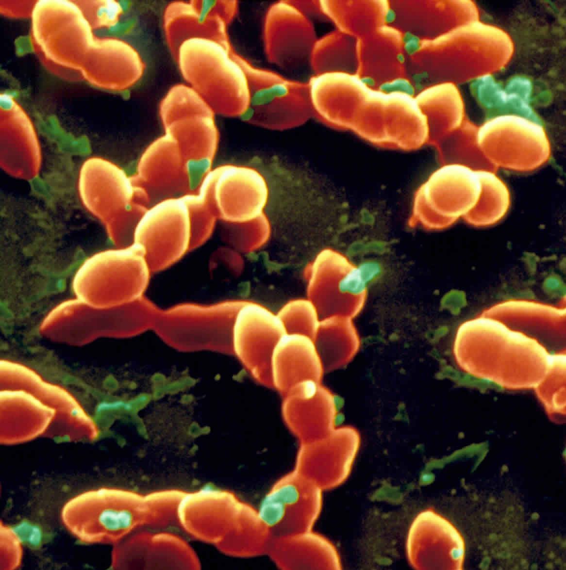 A close up of a bunch of orange bacteria on a black background