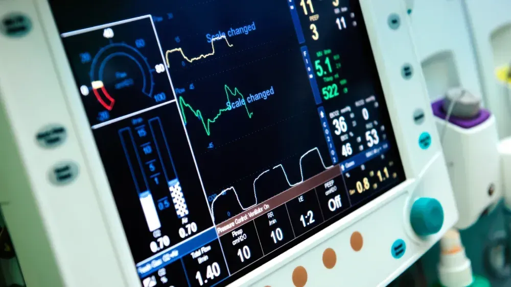 Hospital patient monitor showing vital signs with colorful ECG and waveform displays