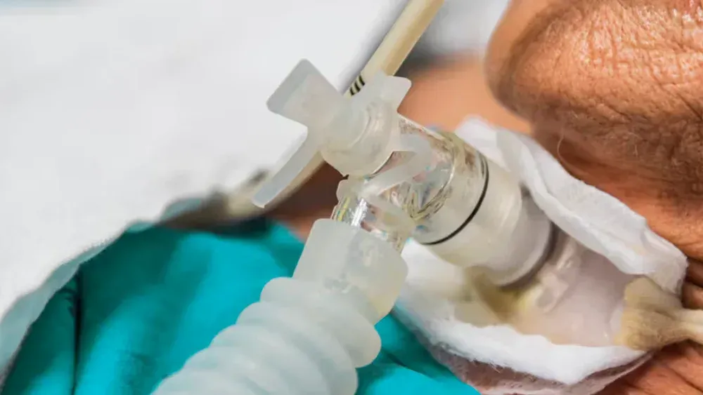 Close-up of a medical breathing tube and connector attached to a patient in a clinical setting