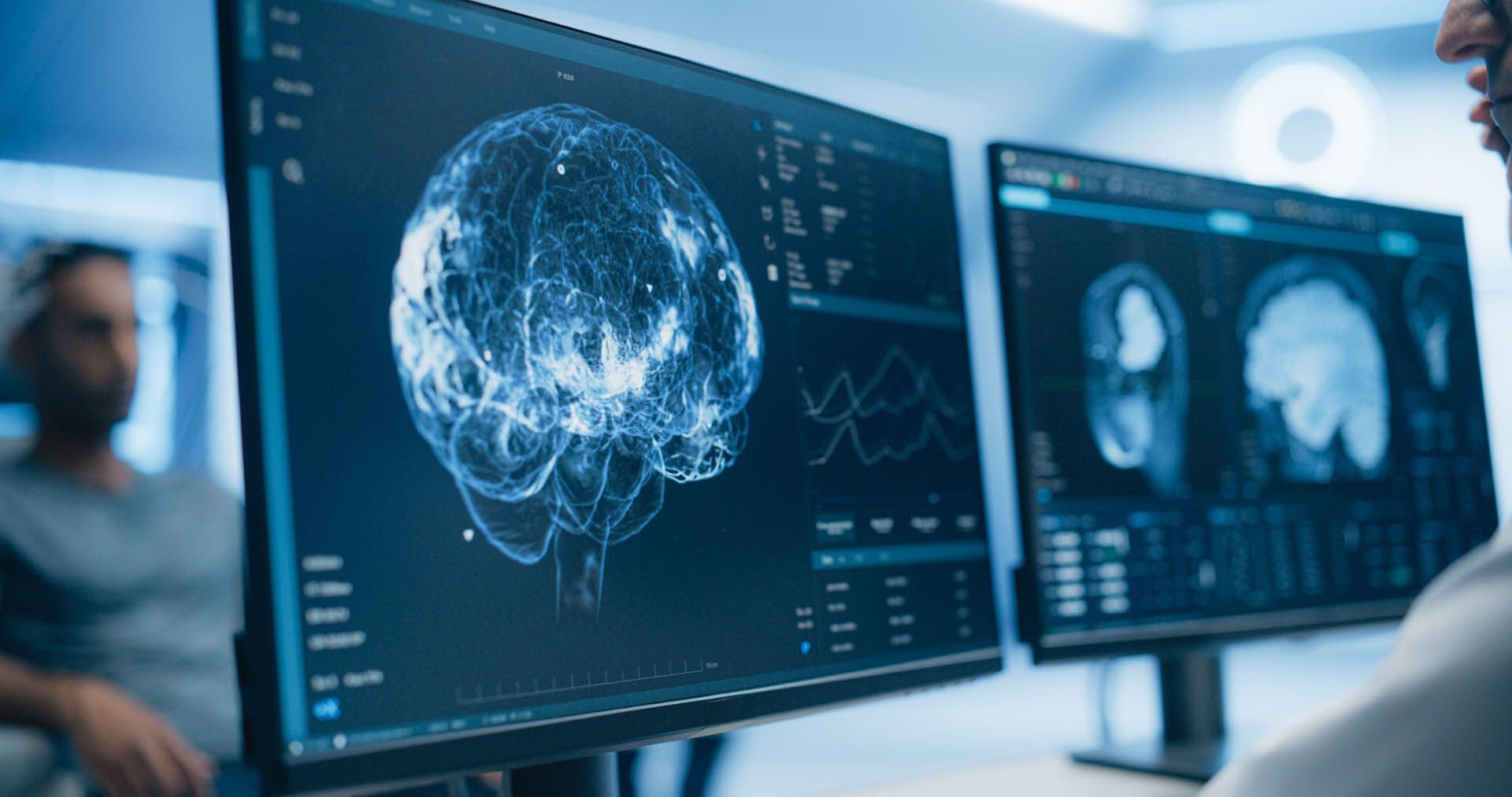 Medical monitors showing brain scans and neural network visualization in a clinical setting