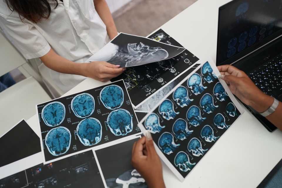 Hands reviewing brain scan X-rays and MRI images on a desk