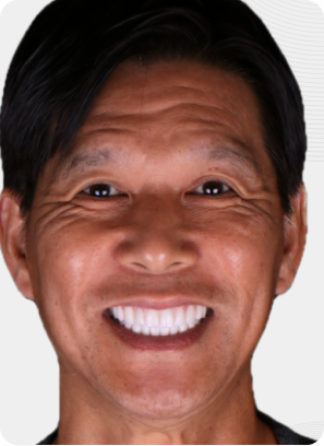 Smiling person with bright white teeth.