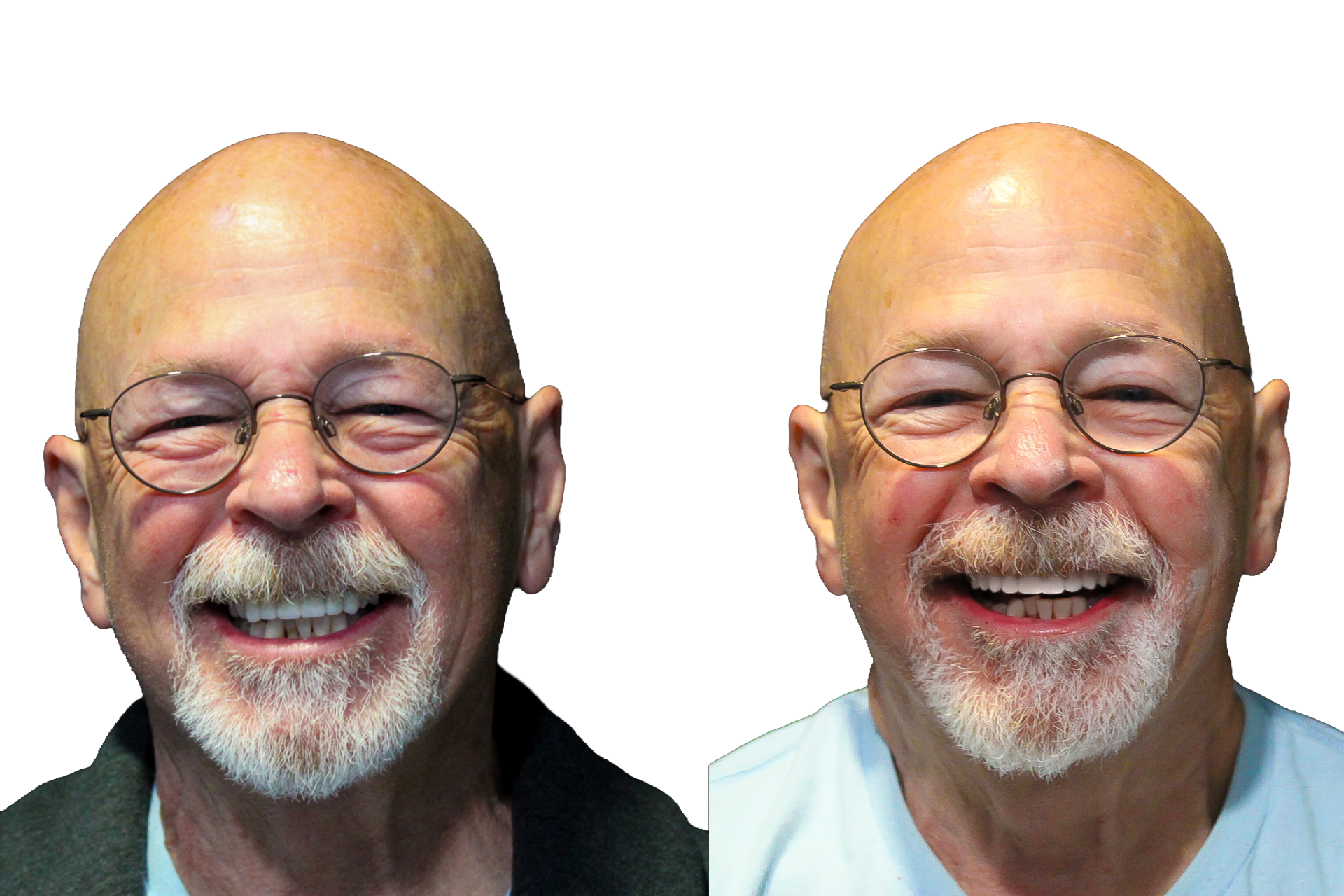 Side-by-side portraits of a smiling bald man with glasses and a gray beard on white background