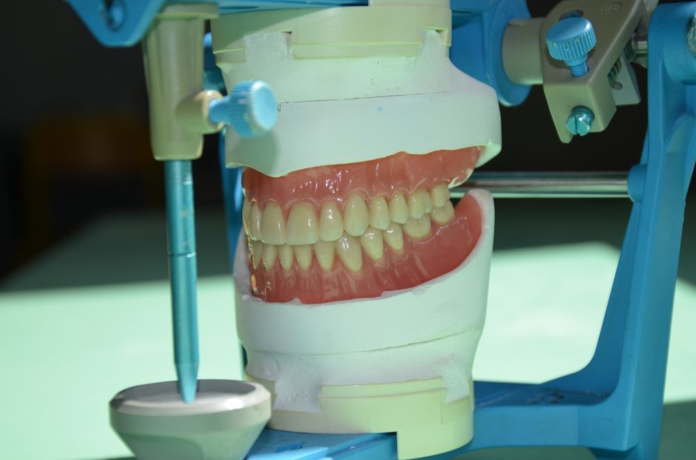 Dental model with teeth in an articulator. Pink gums, white teeth, blue metal framework. — AB Esthetic Dental Laboratory in Brisbane, QLD