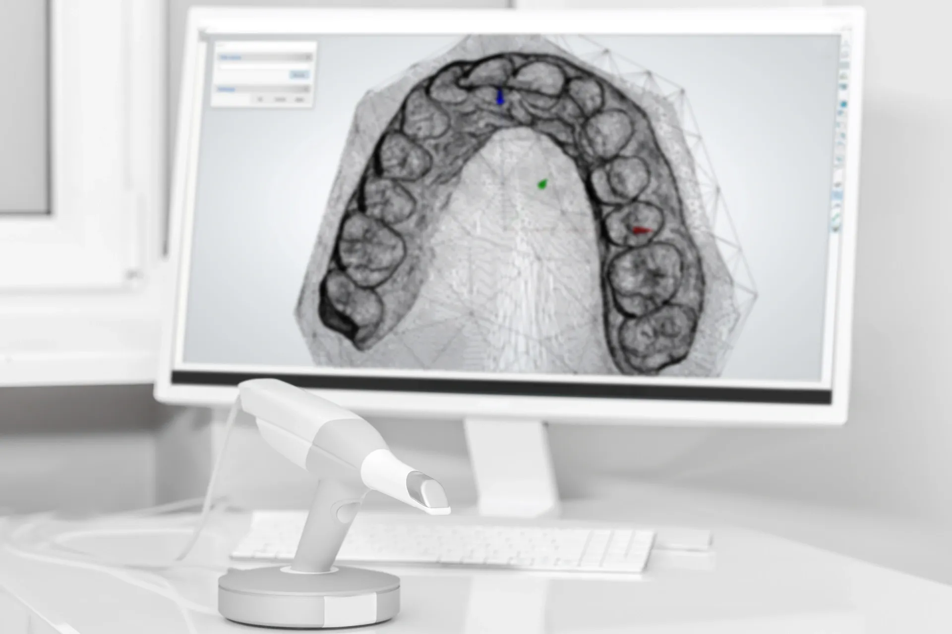 Dental Intraoral Scanner With a 3d Scan of Teeth — AB Esthetic Dental Laboratory in Brisbane, QLD