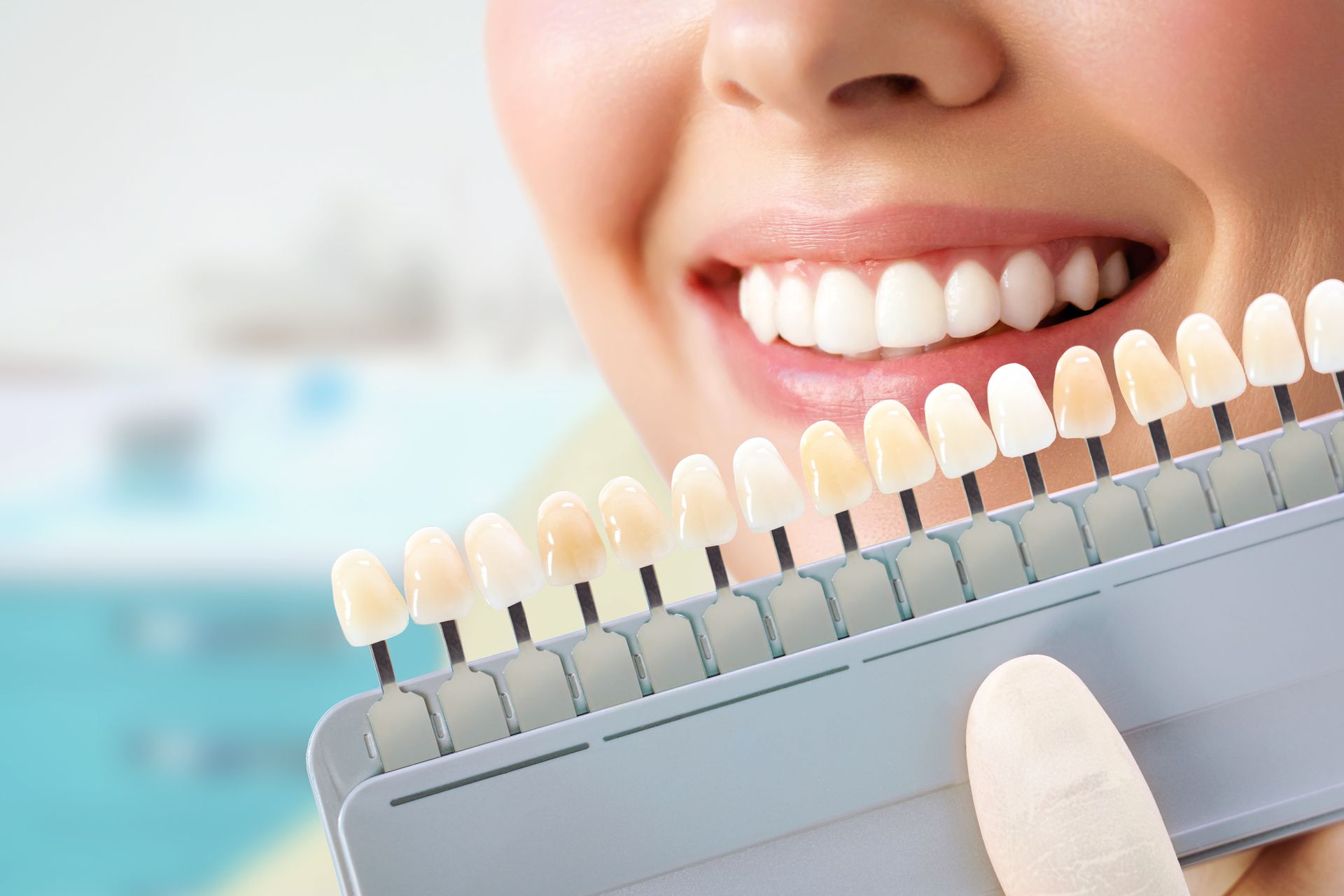 Sbiancamento dentale