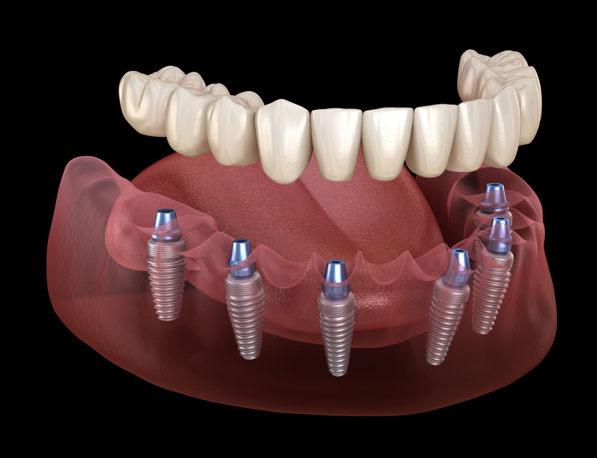 studio dentistico, pn dental, pordenone