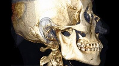 CENTRO DE RADIOLOGÍA MAXILOFACIAL Y DIAGNÓSTICO DENTAL