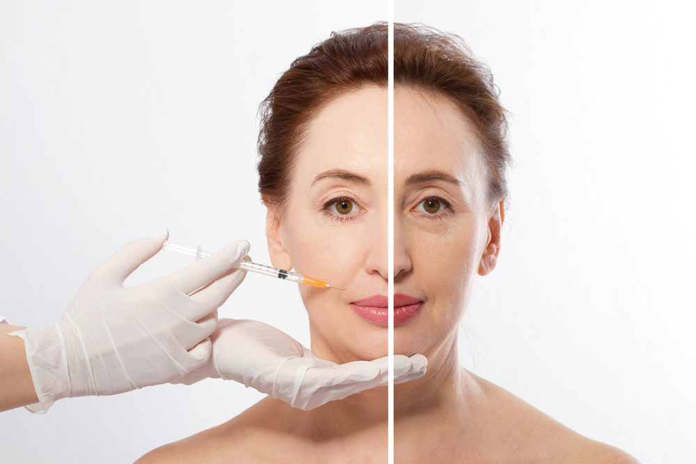 Dermal Fillers 101: A Comprehensive Guide to Aesthetic Enhancements