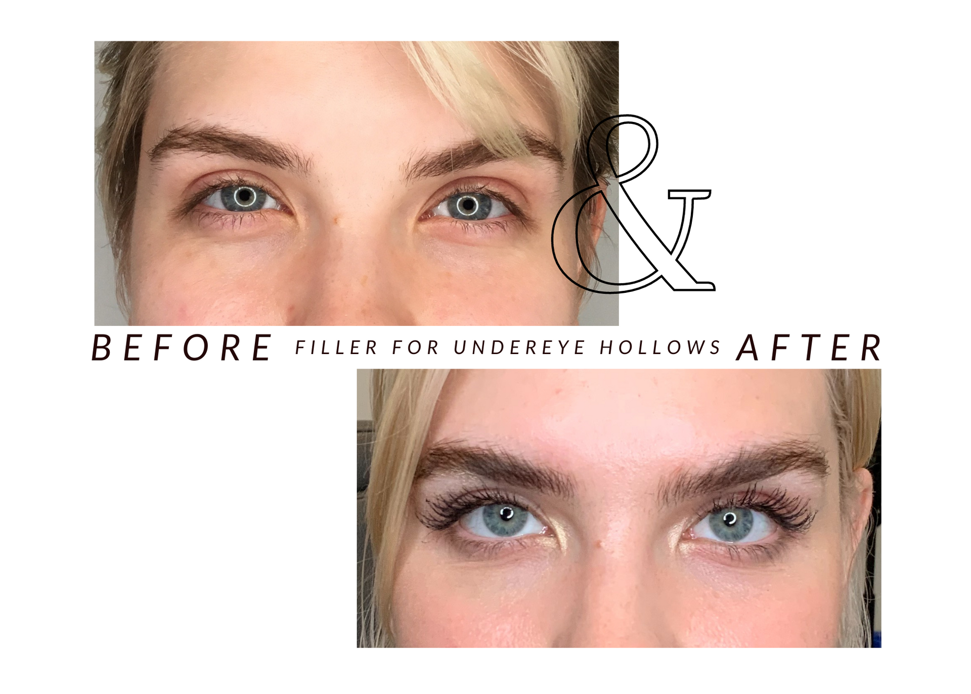 A before and after photo of a woman 's eyes.