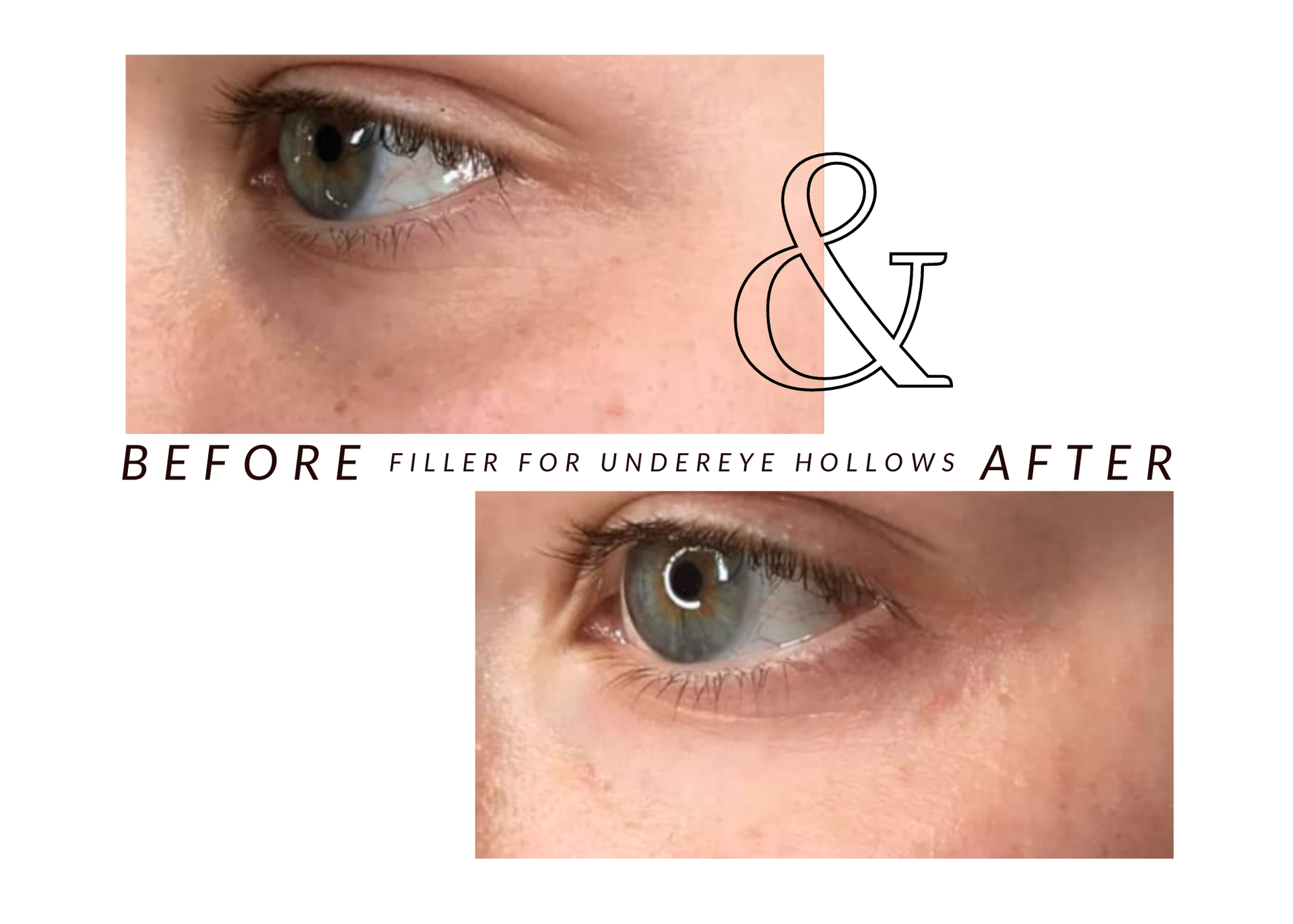 A before and after picture of a woman 's eye.