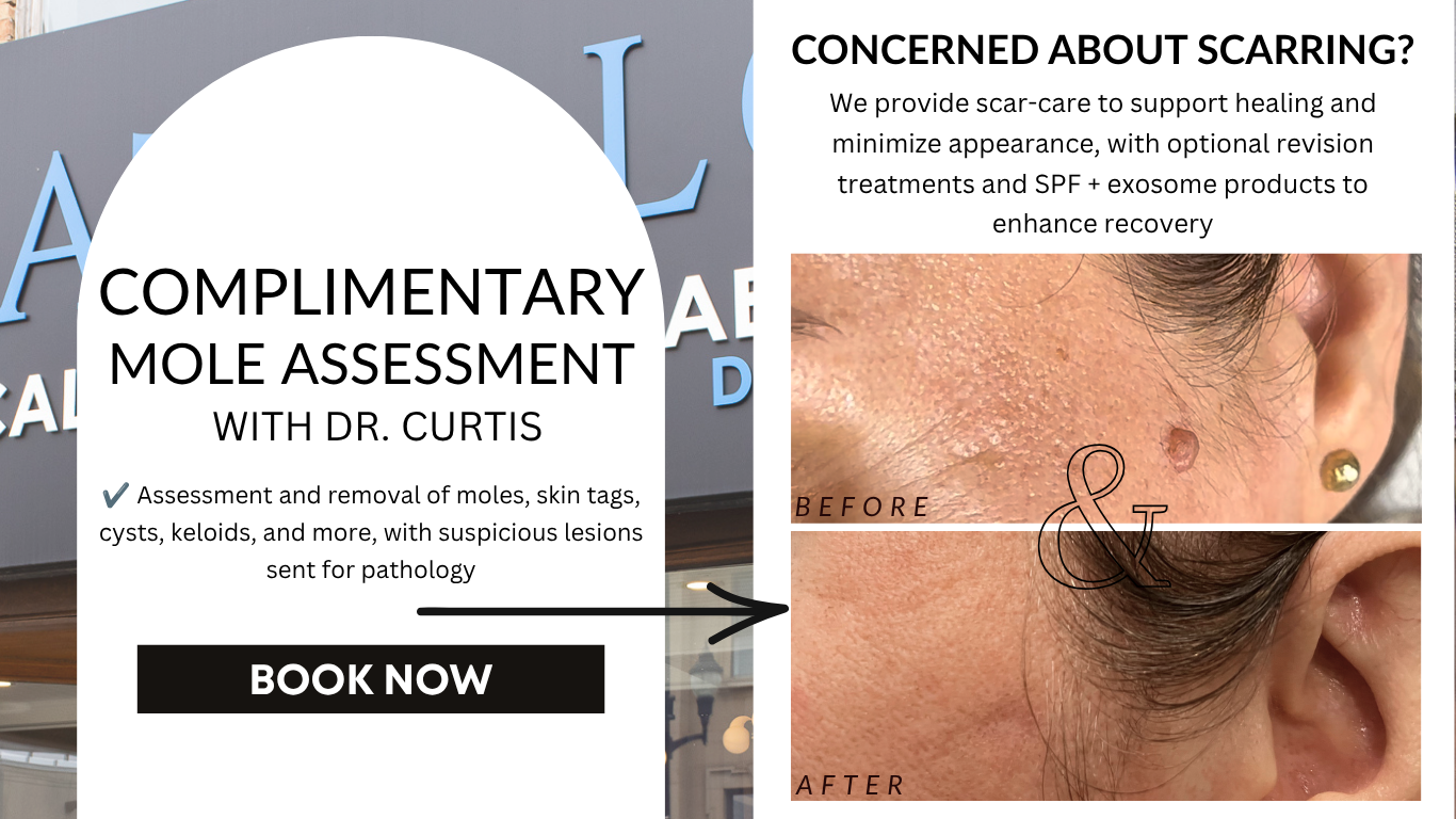 Promotional flyer for complimentary mole assessment with before-and-after skin scar photos and a Book Now button