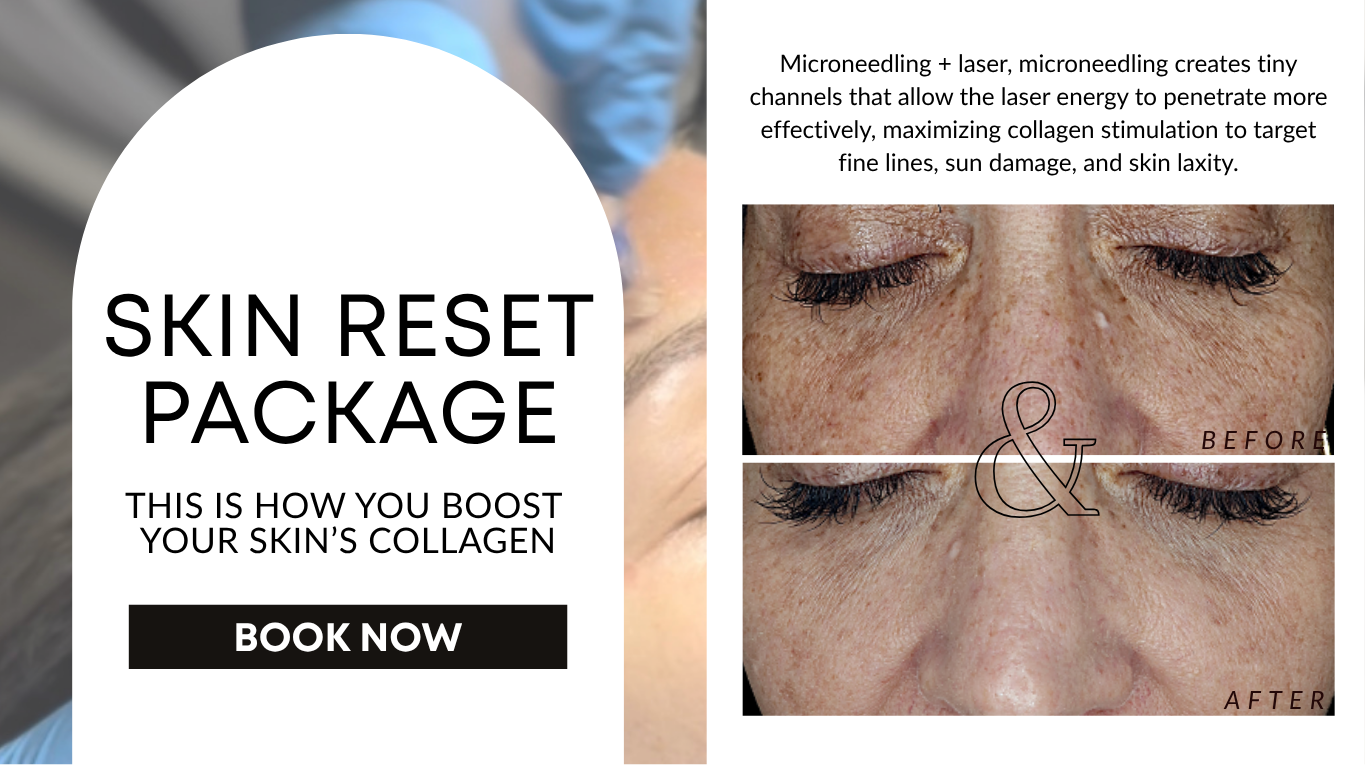 Promotional graphic for skin reset package with button, and skin comparison.