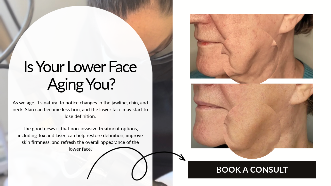Promotional graphic for skin reset package with button, and skin comparison.