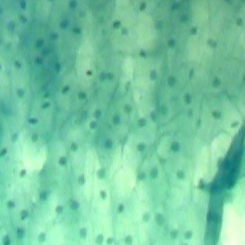 Histerescopia