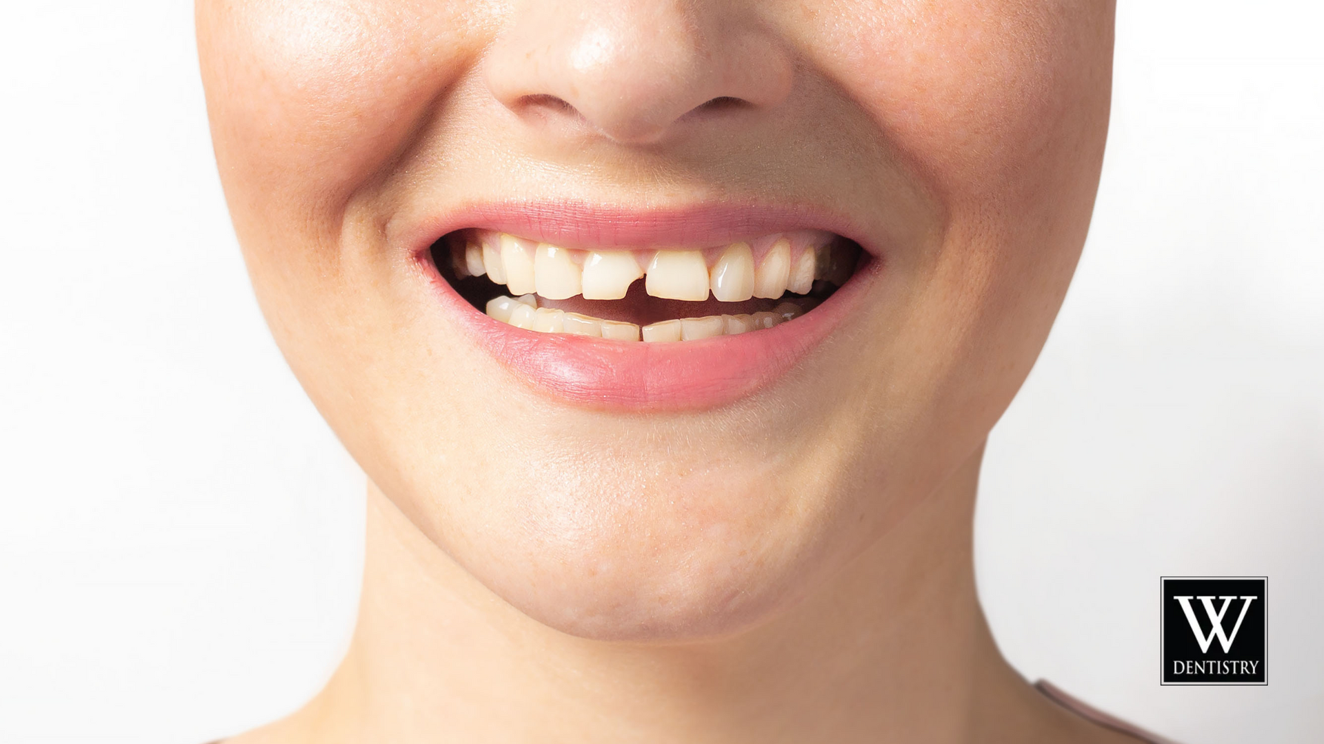 A close up of a woman 's mouth with a smile on her face.