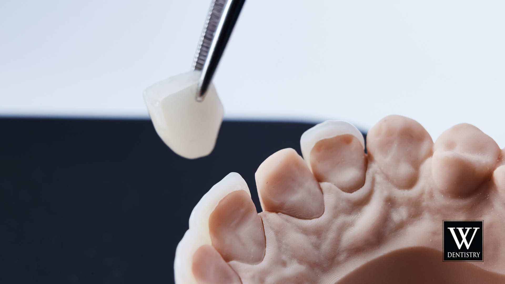 A model of a person 's teeth with a w logo in the corner