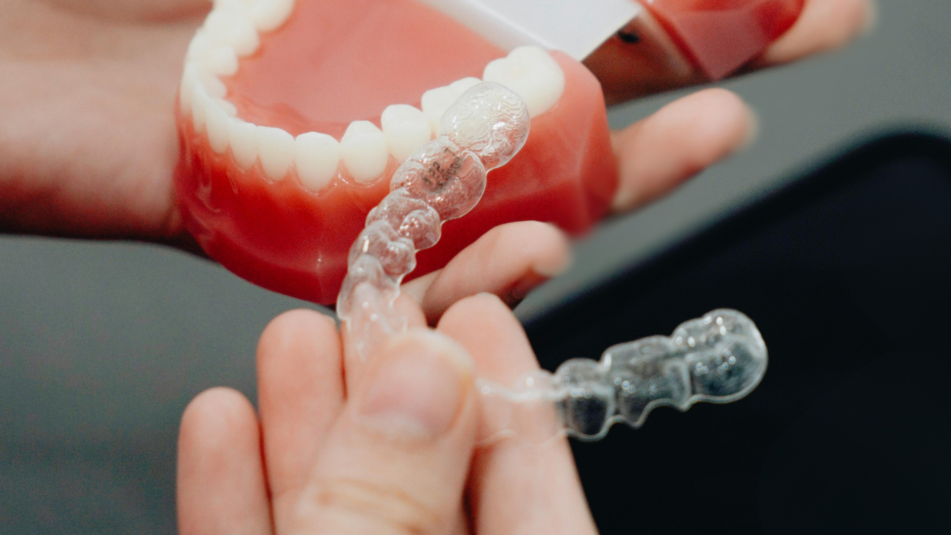What Can You Eat With SureSmile® Clear Braces? Patient Guide