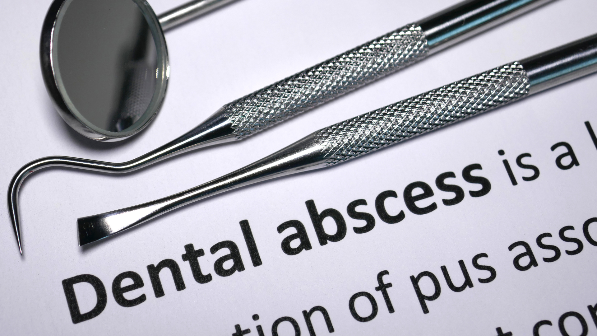 How Do You Know If a Dental Abscess Is Dangerous? Warning Signs Explained