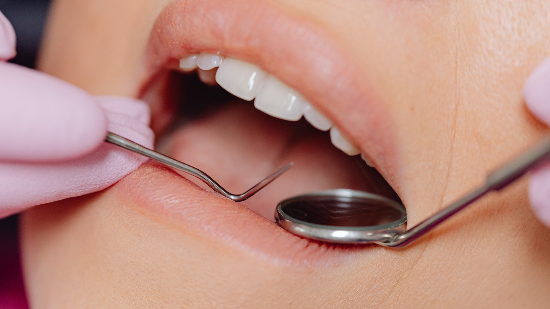 What Happens During an Emergency Dental Appointment? Step-by-Step Guide