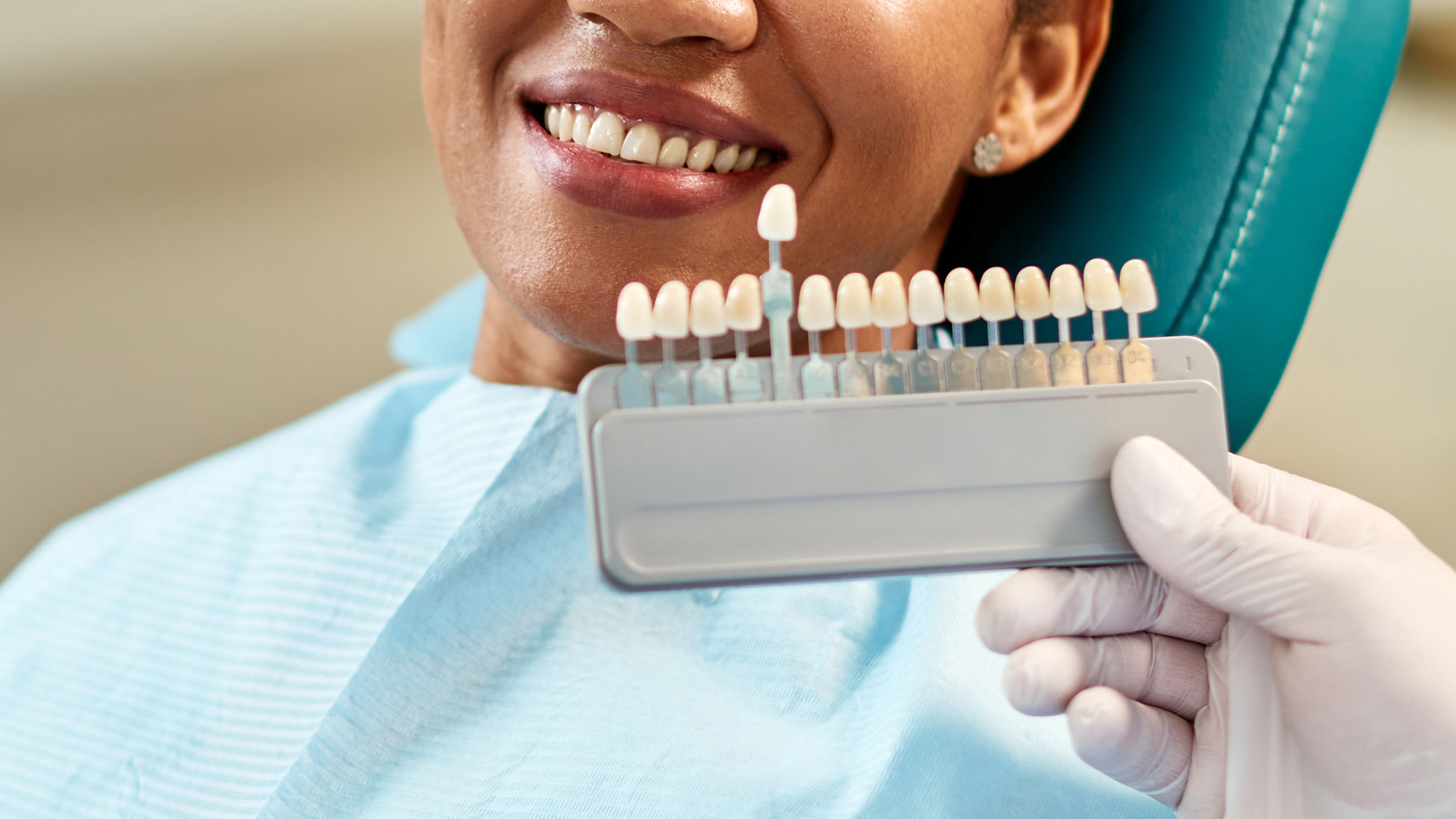 How to Know If You’re a Good Candidate for Veneers