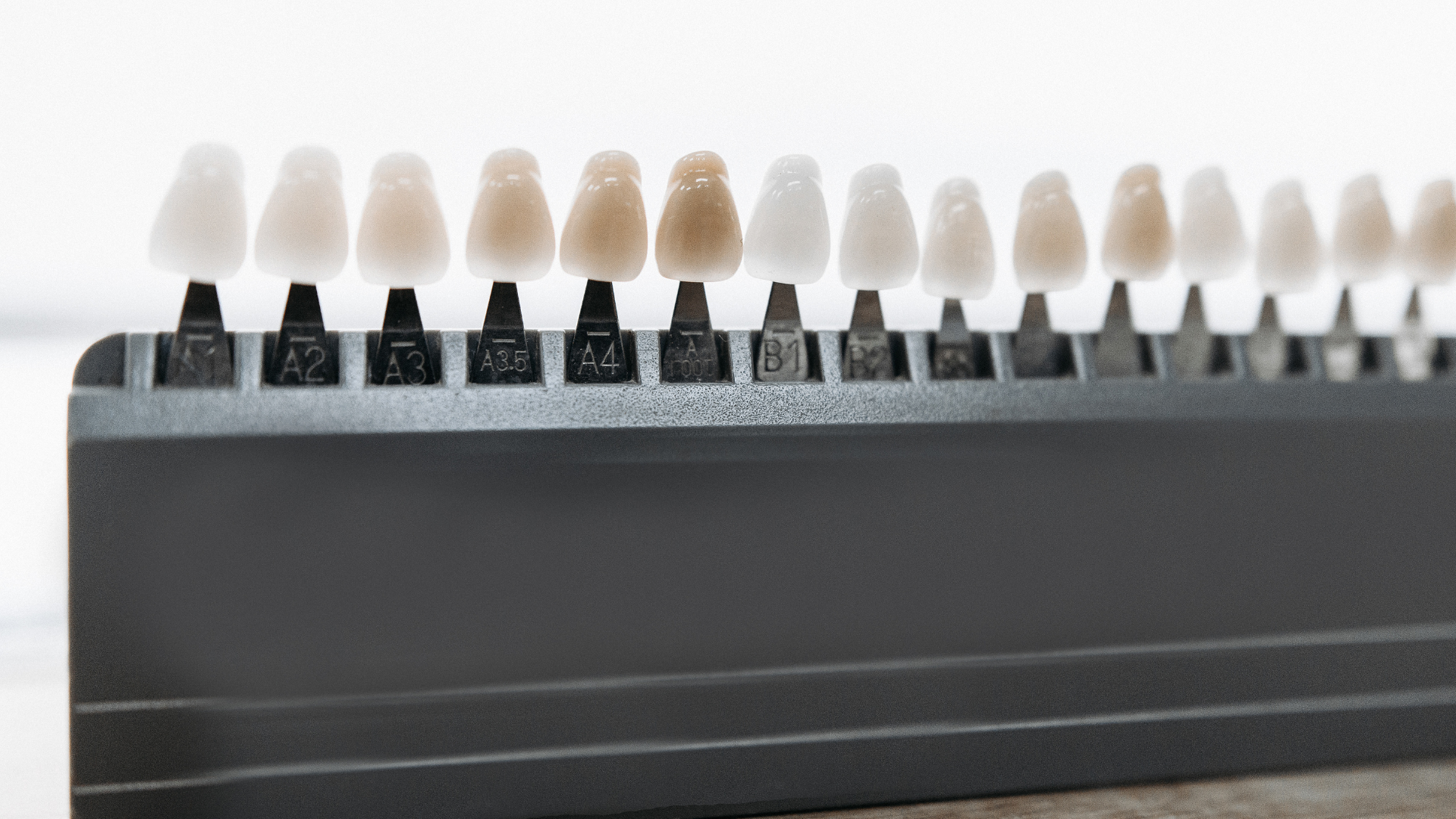 Are Veneers Permanent or Do They Need Replacement Over Time?