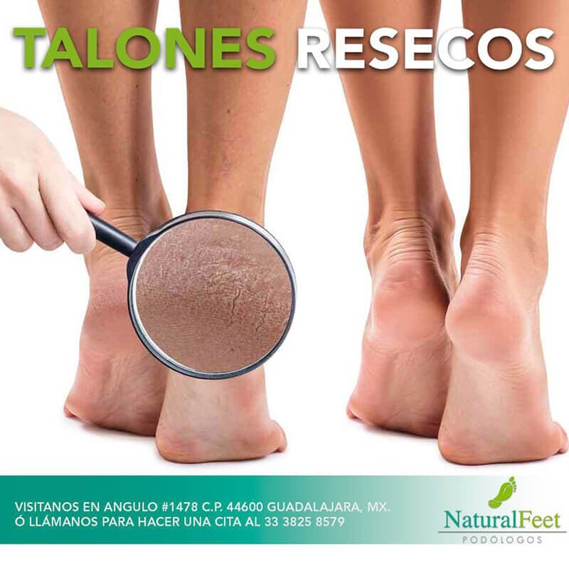 NATURAL FEET