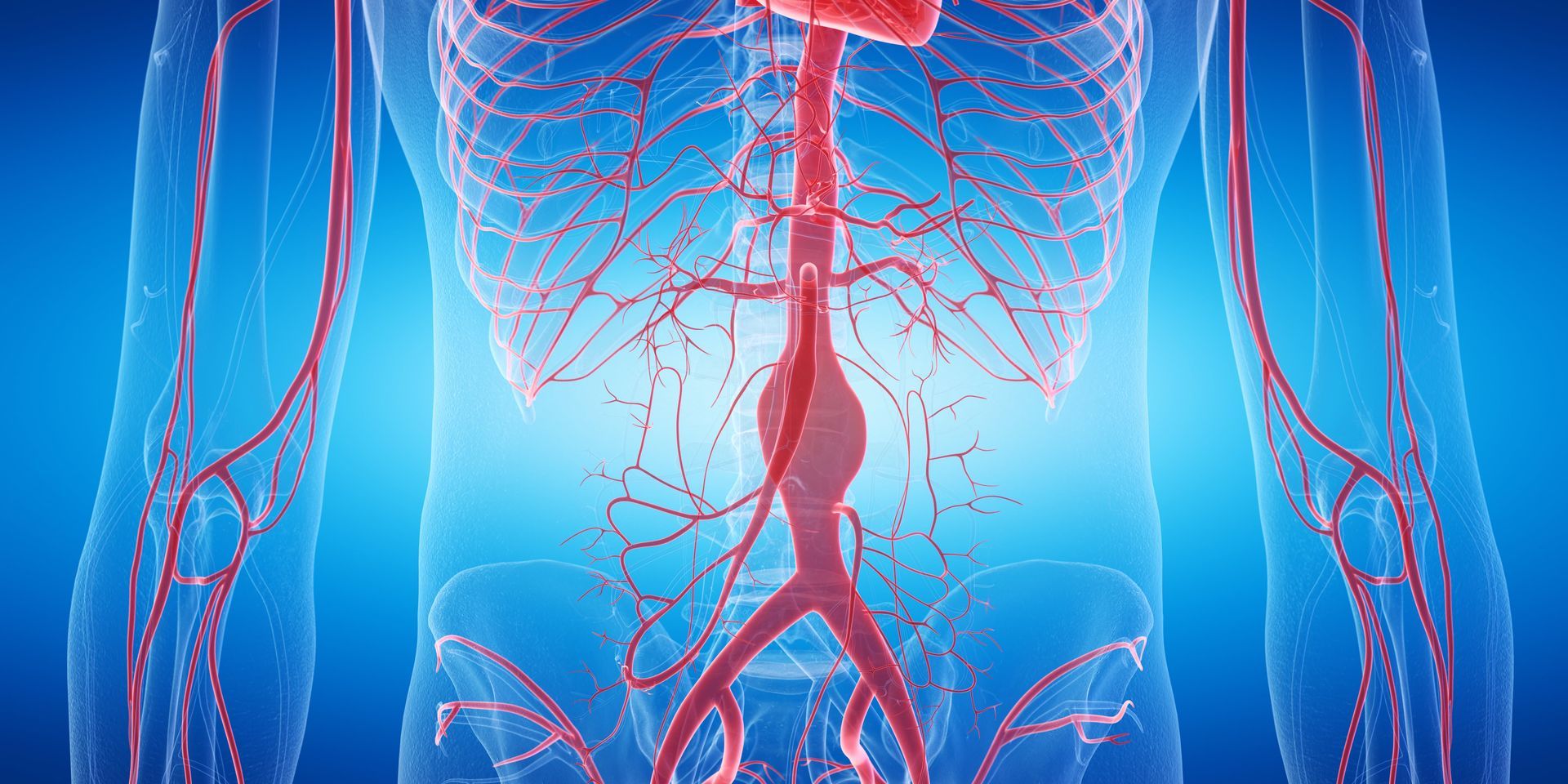 Aneurisma de Aorta