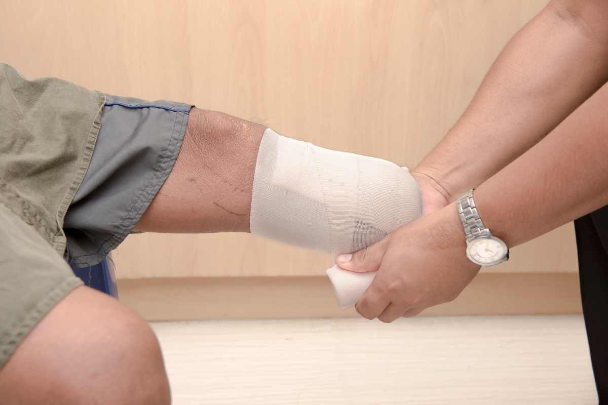 A doctor measuring residual limb for prosthetic near Lawrenceburg, Indiana (IN)