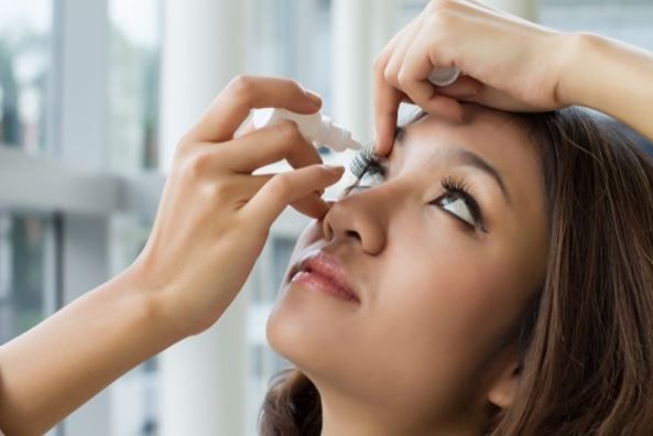 Woman applying eye drops, looking up, holding bottle near eye.
