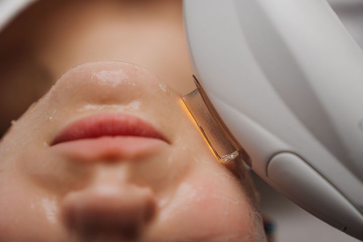 Facial laser treatment: device on cheek, emitting light, skin is wet.
