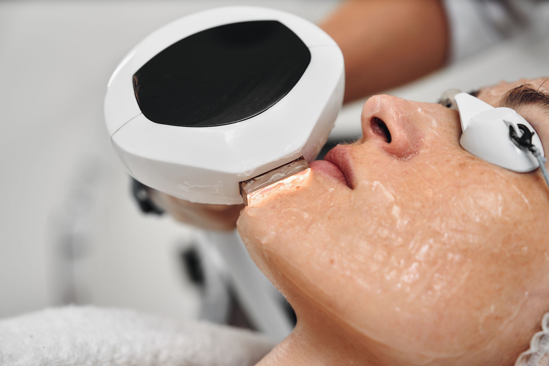Woman receiving facial laser treatment.