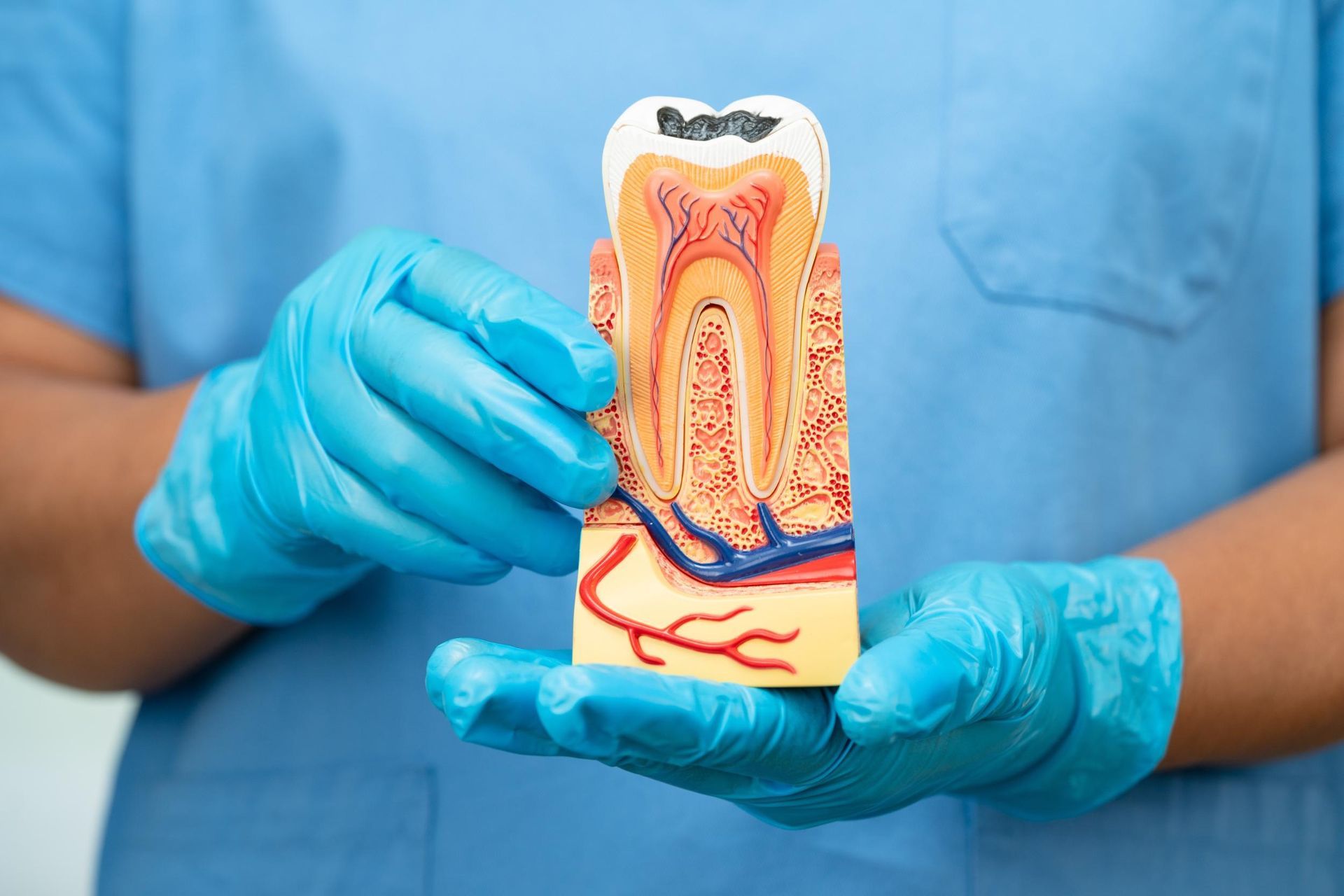 Gloved hands holding a tooth anatomy model with a cross-section of roots and pulp