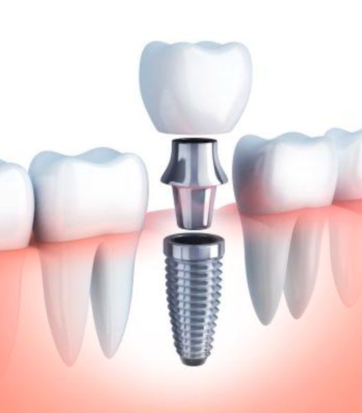 urquiza-dental