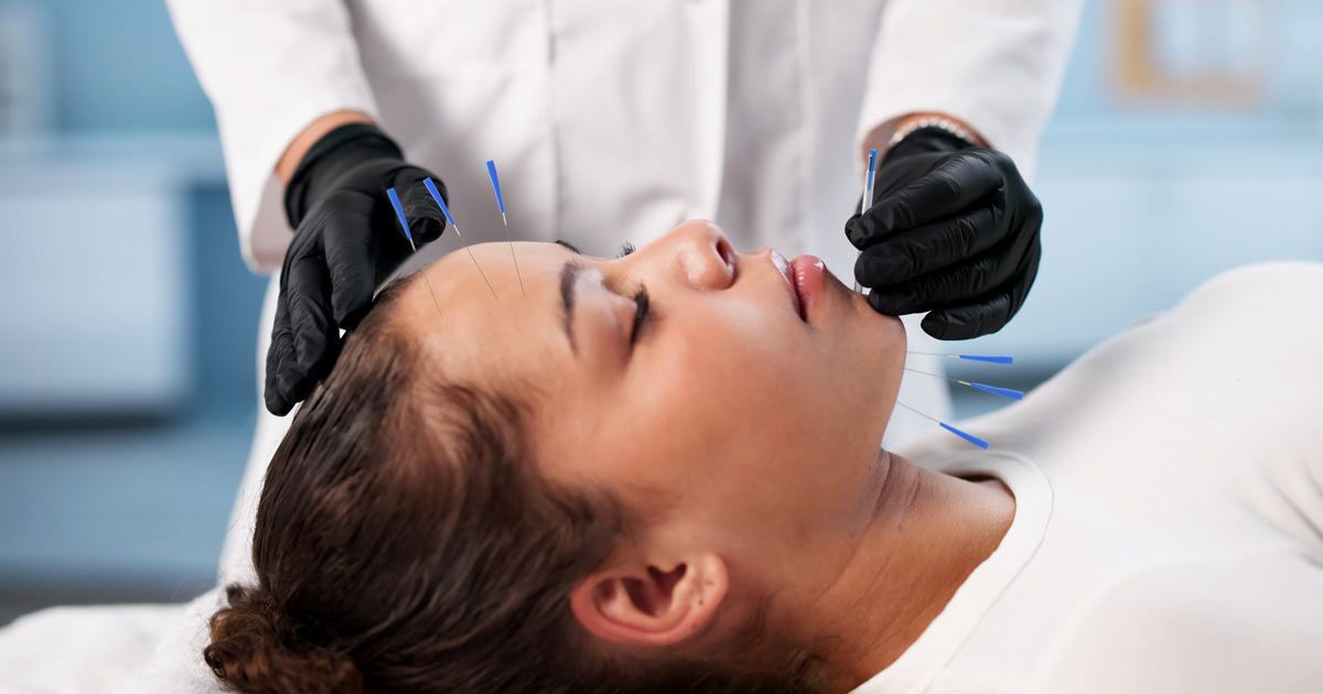 Woman receiving acupuncture treatment to face, eyes closed. After visiting websites for acupuncturists