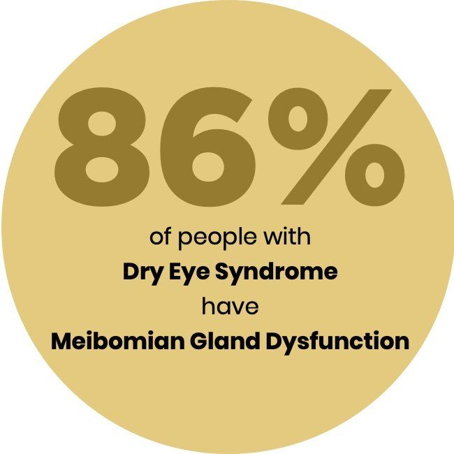 A sticker that says that 86 percent of people with dry eye syndrome have meibomian gland dysfunction '
