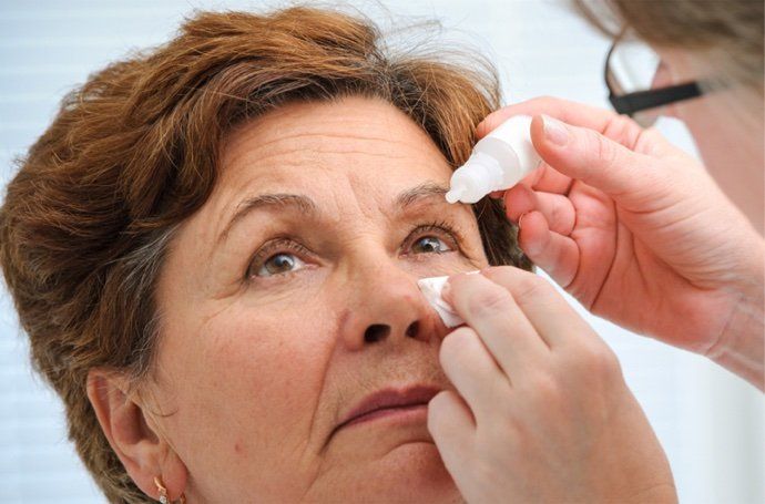 Optometrist adding eyedrops to female patient's eye.