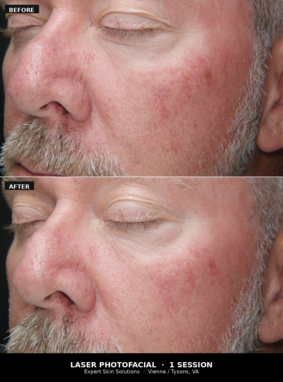 Regular photo taken during a Nexa skin analysis scan