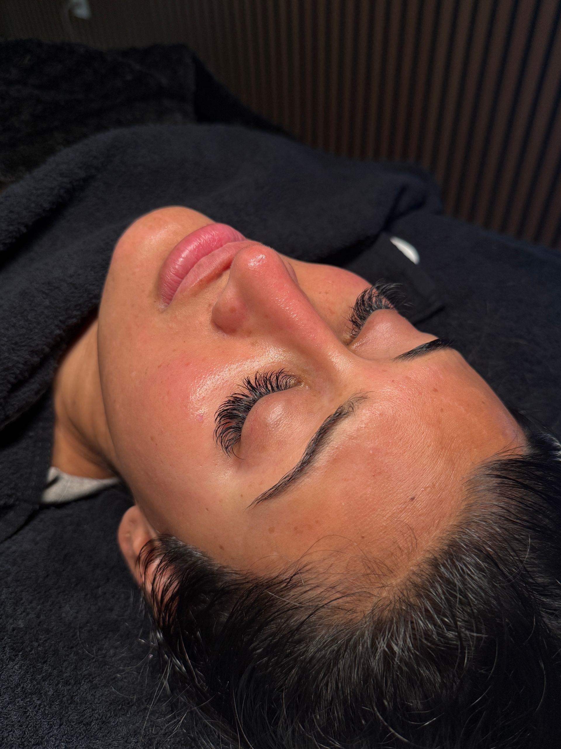 Actual patient during a Deluxe Hydrafacial. Bare skin, no product on the surface.