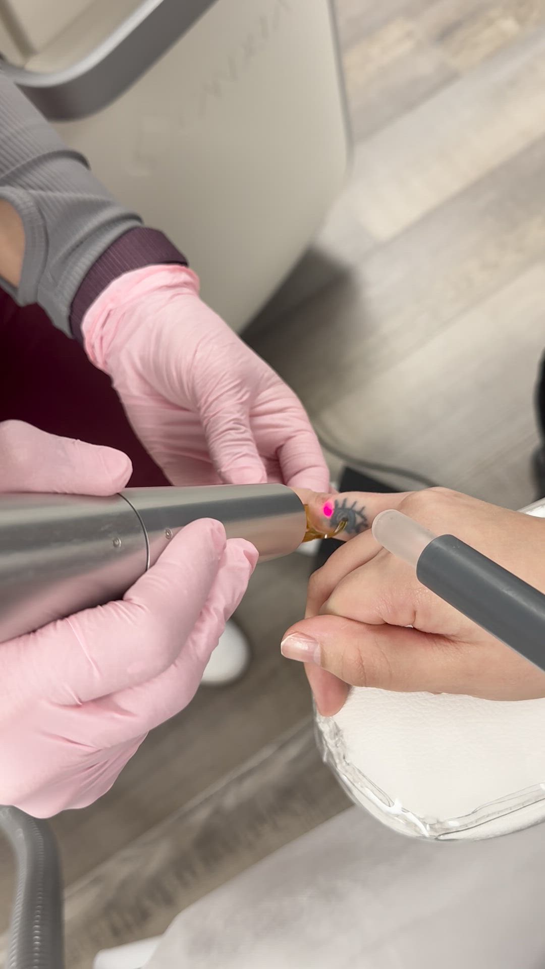 PicoWay tattoo removal at Expert Skin Solutions