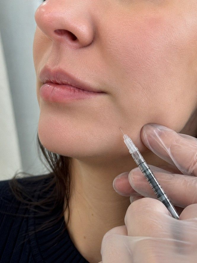 Lyndsey at Signature Aesthetics administering masseter botox injection into client's jaw in Nottingham clinic