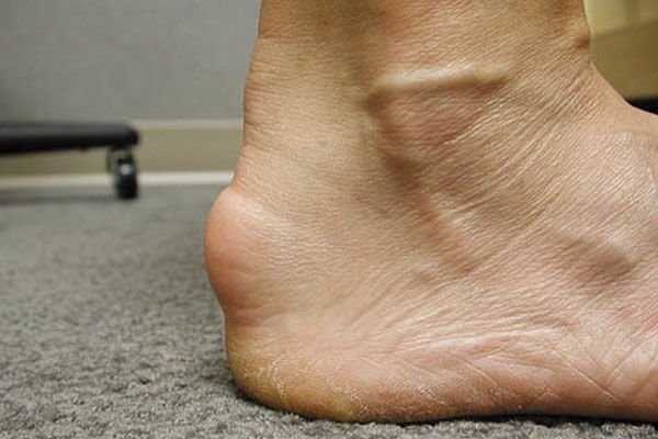 Dr Yeo Brisbane Foot & Ankle Surgeon