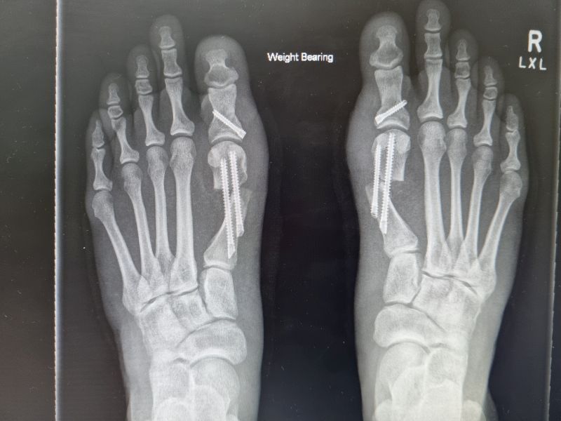 Dr Yeo Brisbane Foot & Ankle Surgeon