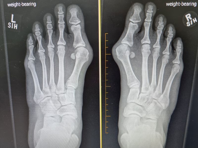 Dr Yeo Brisbane Foot & Ankle Surgeon