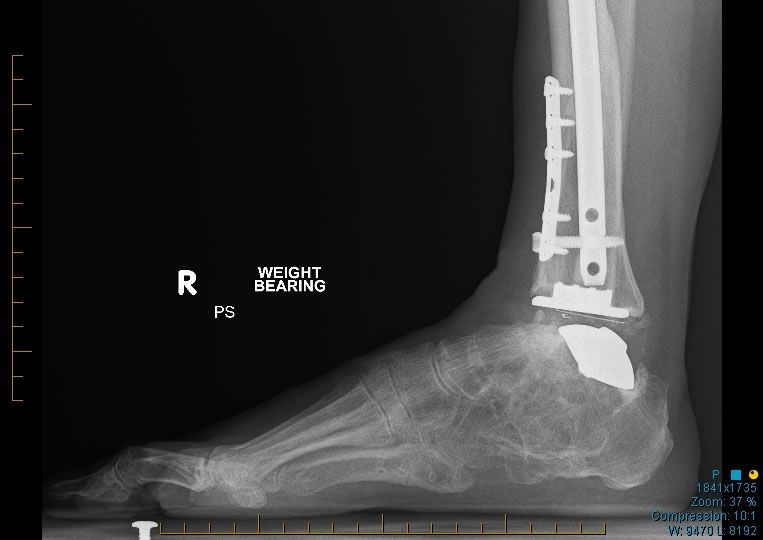 Dr Yeo Brisbane Foot & Ankle Surgeon